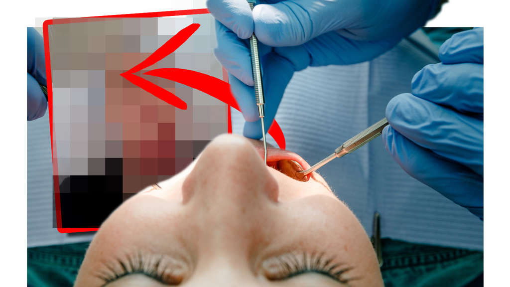 Zahnarzt vergewaltigt patientin